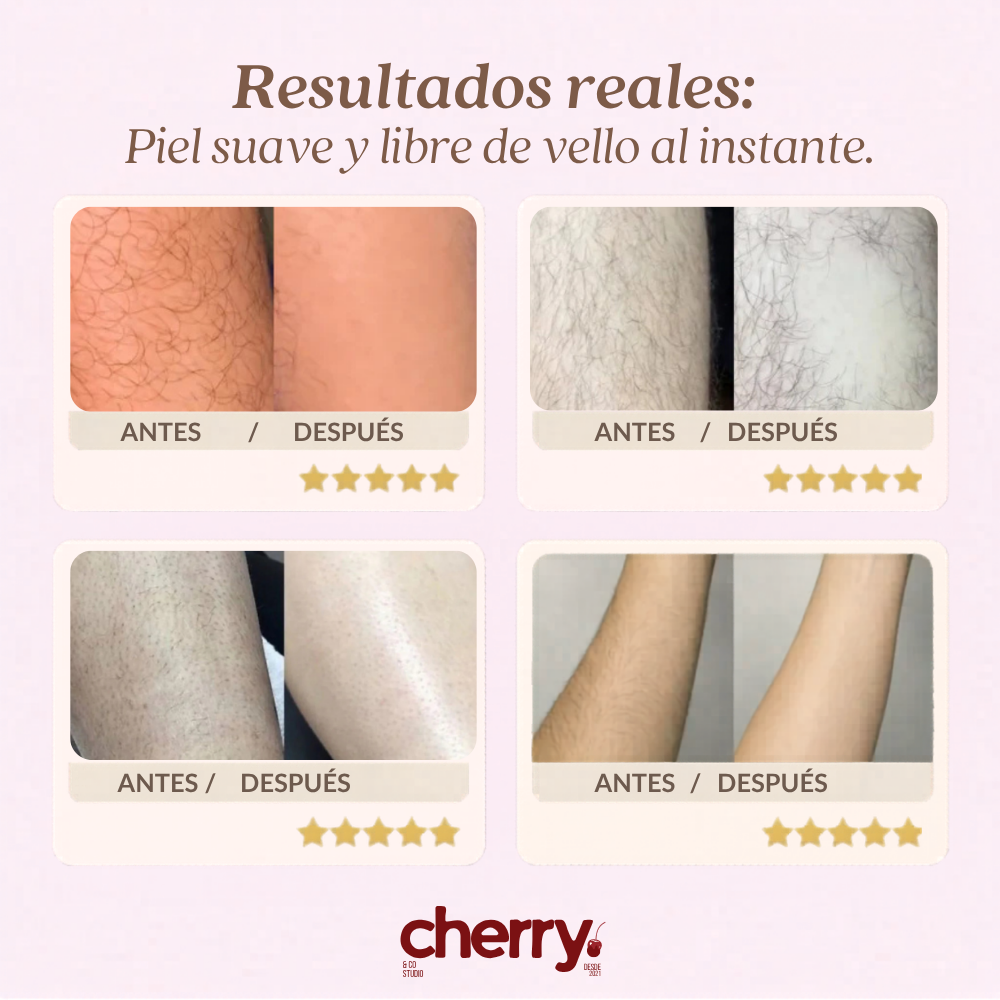 Depiladora Crystal by Cherry™